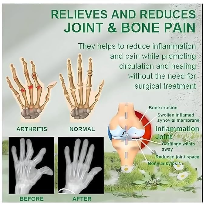 Bee Venom Joint and Bone Therapy Cream (Pack Of 2)