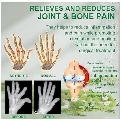 Bee Venom Joint and Bone Therapy Cream (Pack Of 2)