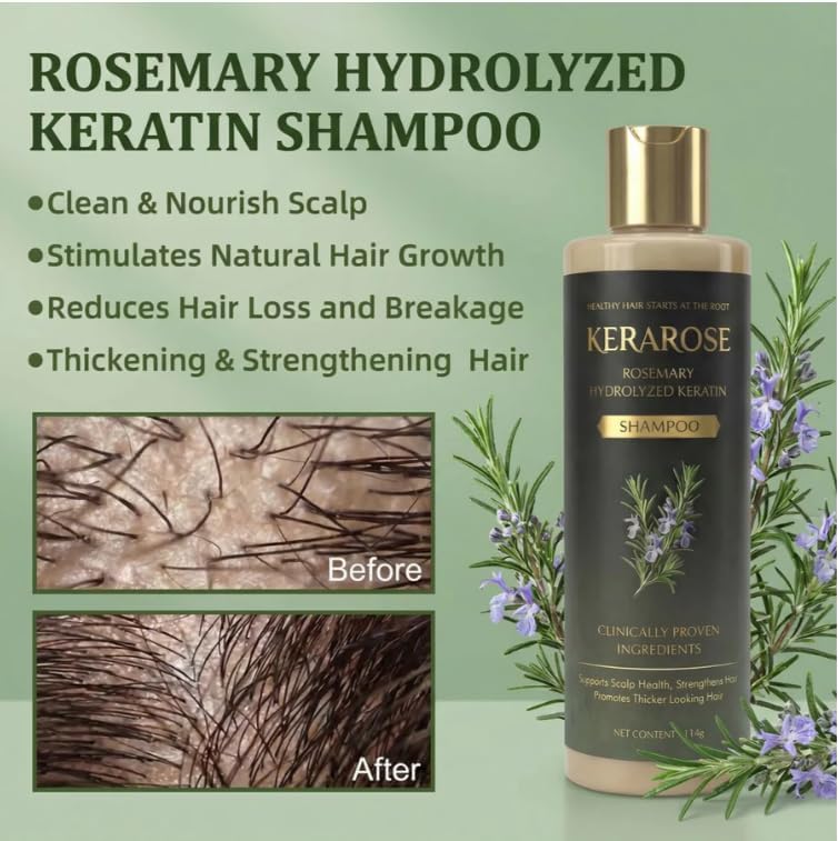 Rosemary Growth Support Shampoo (Pack Of 2)