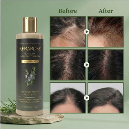 Rosemary Growth Support Shampoo (Pack Of 2)
