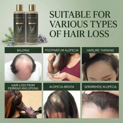 Rosemary Growth Support Shampoo (Pack Of 2)